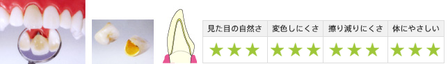 見た目の自然さ3・変色しにくさ3・擦り減りにくさ3・体にやさしい3