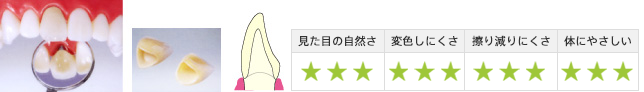 見た目の自然さ3・変色しにくさ3・擦り減りにくさ3・体にやさしい3