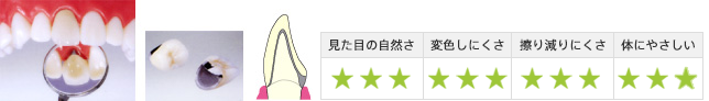 見た目の自然さ3・変色しにくさ3・擦り減りにくさ3・体にやさしい3