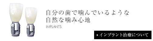 インプラント治療について